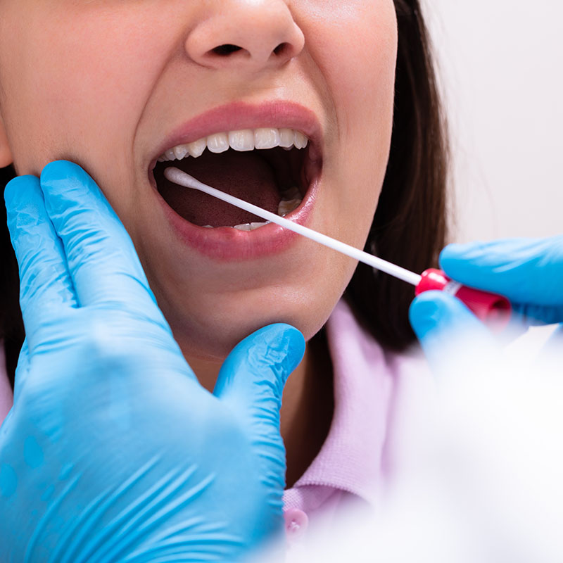 test-trod-angine-pharmacie-du-bourg-francheville